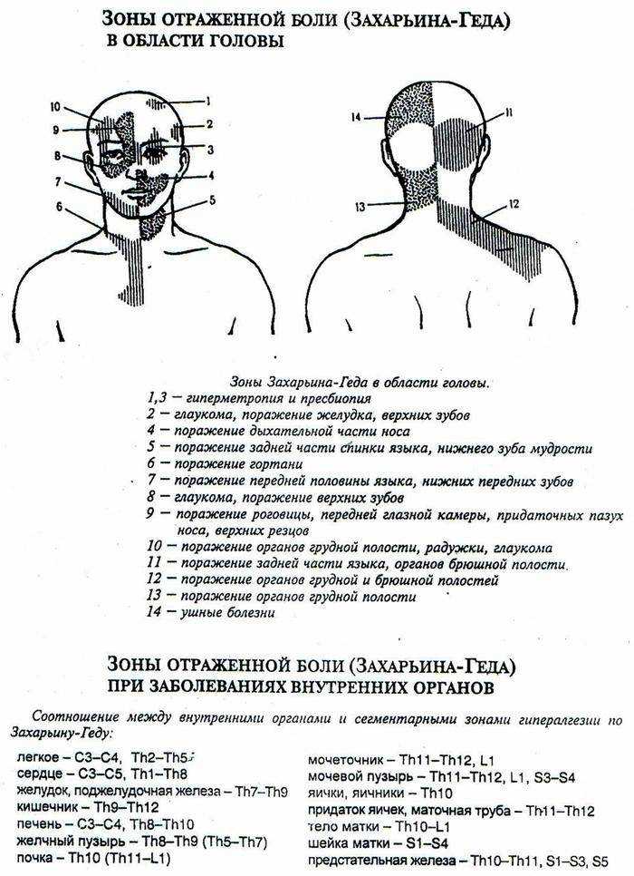 Схема головных болей у человека