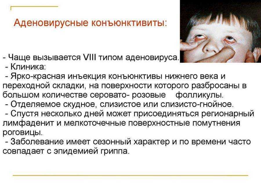 Аллергия: ликбез для аллергика. диагностика, симптомы, лечение