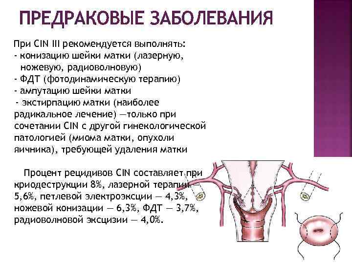 Предраковые матки. Протокол электроконизации шейки матки. Предраковые процессы шейки матки. Конусовидная ампутация шейки матки.