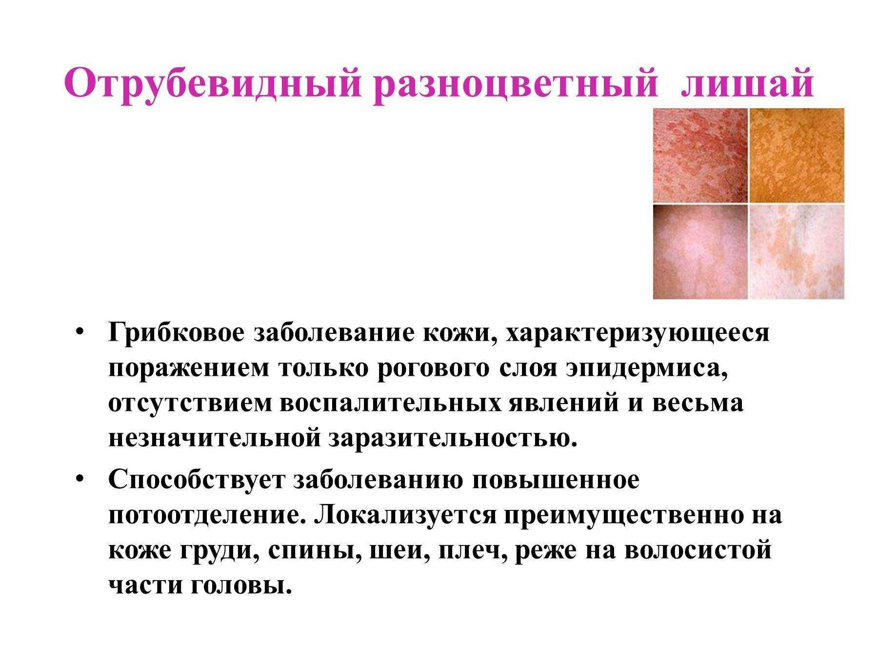 Причины нарушения кожи. Отрубевидный лишай локализуется. Розовый отрубевидный и разноцветный лишай. Поражение кожи розовый лишай. Симптомы отрубевидного (разноцветного) лишая.