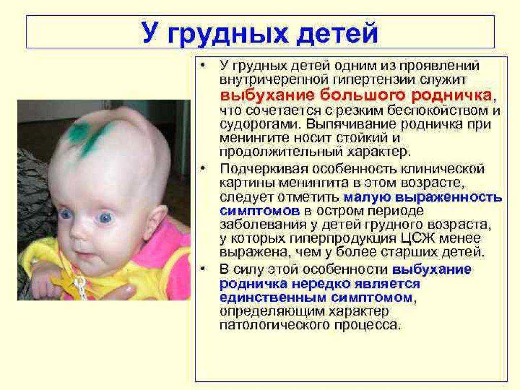 Синдром грефе (graefe)