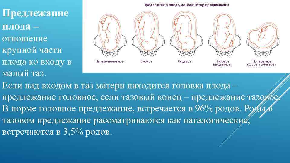 Ведение родов при тазовом предлежании