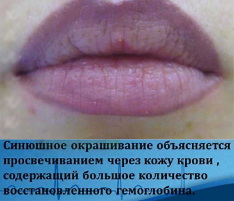 Интимная пластика: быть красивой во всех местах