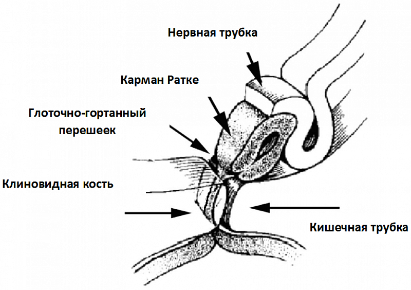 Киста на мрт головного мозга как выглядит, какие виды бывают