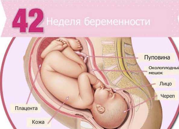 Истмико-цервикальная недостаточность