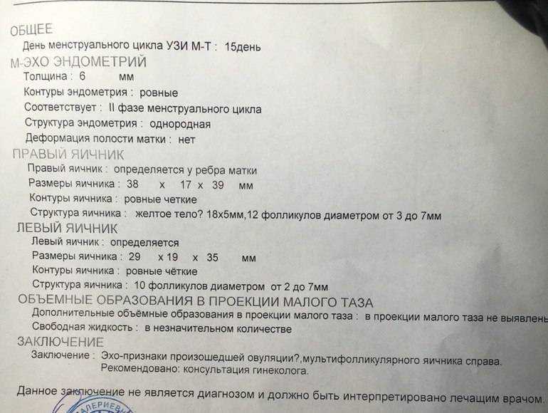Фолликулометрия: что это такое, как делается