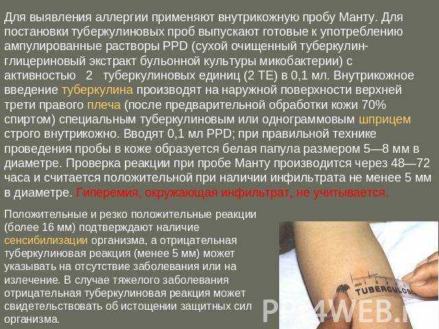 Можно ли мочить манту: сколько дней нельзя мыться, что будет если вода попала на пробу в первый день, влияние влаги на результат