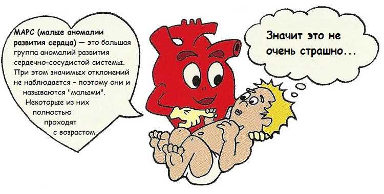 Диагноз МАРС у ребенка нельзя назвать болезнью, поскольку это группа патологий сердечно-сосудистой системы