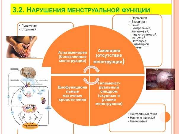 Гиперменструальный синдром: обильные месячные — это болезнь!