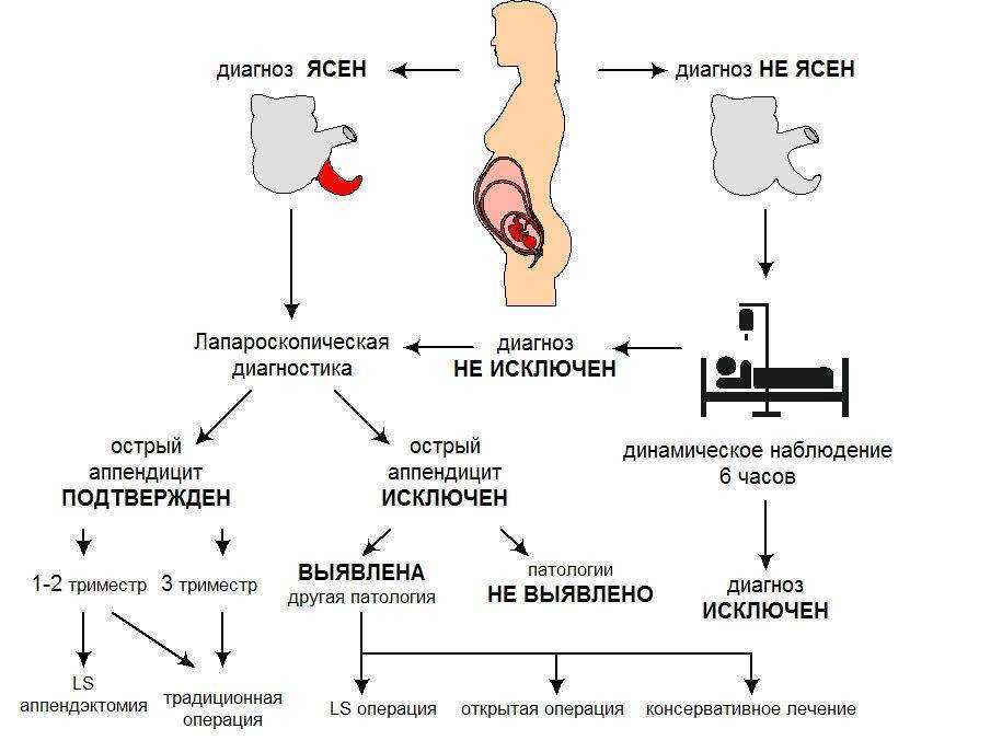 Острый аппендицит у беременных презентация