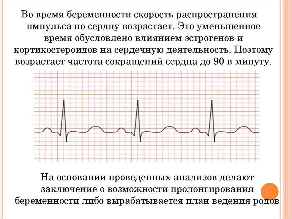 ЭКГ при беременности – простое и безопасное исследование Выявить заранее нарушения работы сердца важно, чтобы избежать осложнений во время родов Разберемся, почему некоторые изменения на ЭКГ при беременности нормальны и не требуют лечения