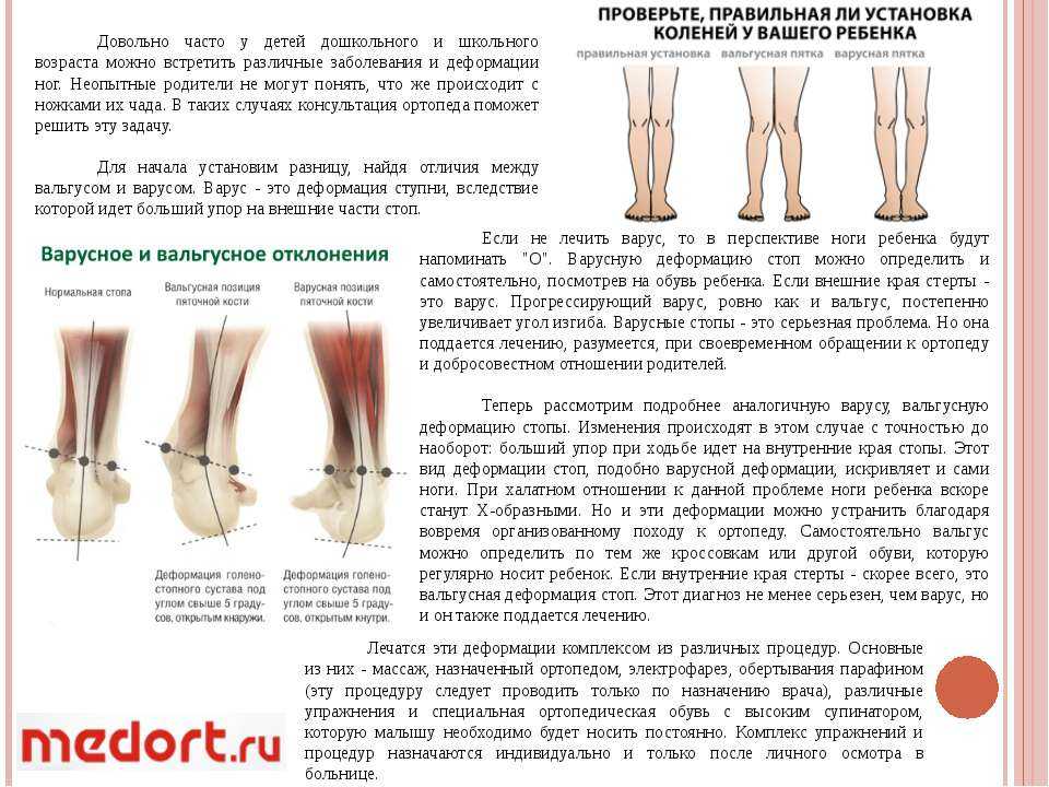 Как научить ребенка сидеть самостоятельно: упражнения для освоения навыка
