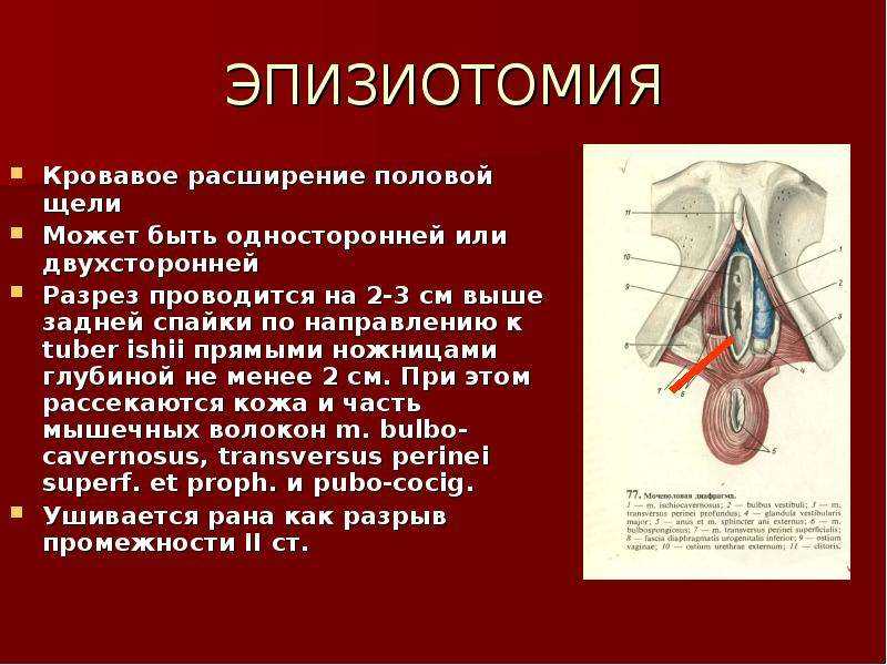 Эпизиотомия и перинеотомия в родах: что это такое, отличия, какие мышцы рассекаются