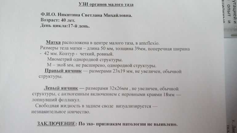 Фолликулометрия: описание и цели методики, расшифровка результатов
