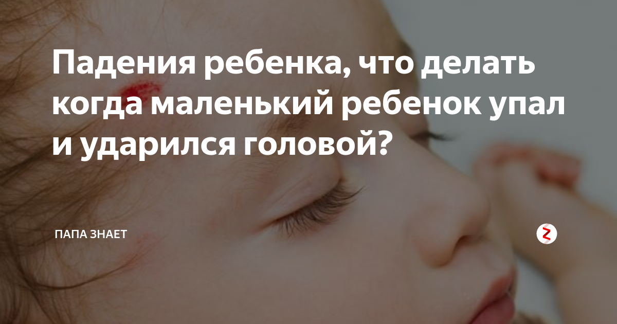 Малыш упал что делать. Если ребёнок ударился головой. Что делать если ребенок ударился. Ребенок упал и ударился затылком. Ребёнок 6 месяцев ударился головой.