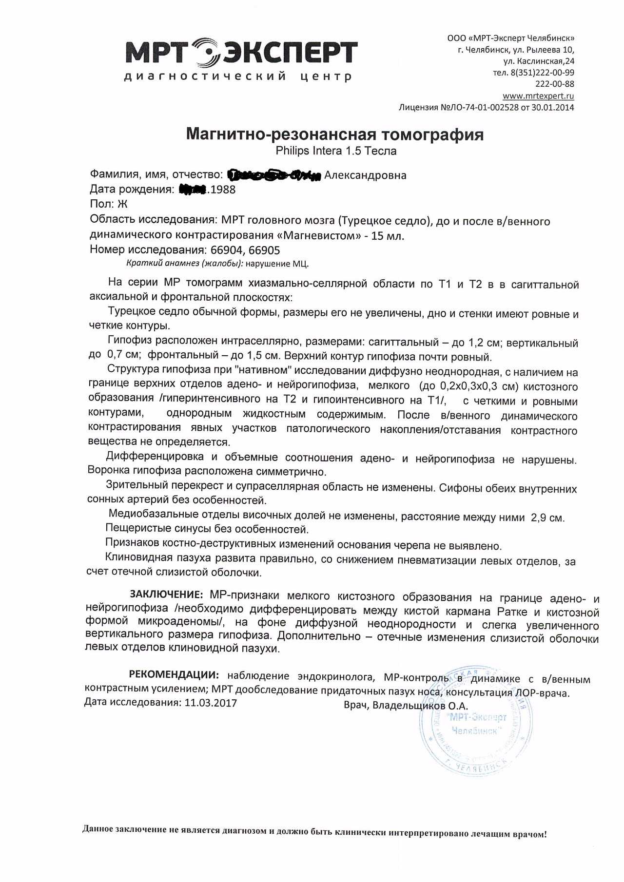 Киста кармана ратке: что это такое и опасно ли образование | parnas42.ru