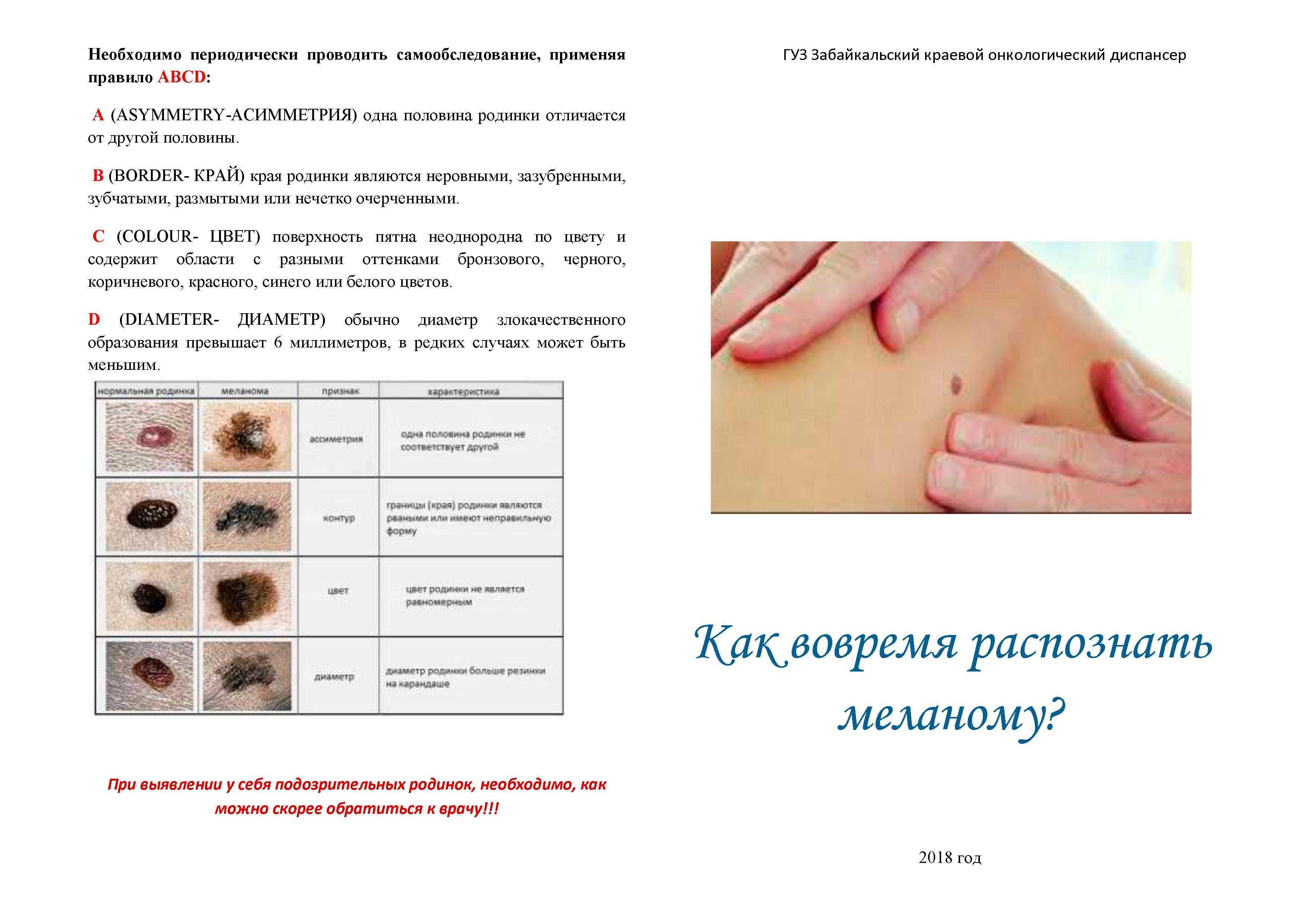 Родимое пятно у новорожденного: причины появления и фото | papillominfo.ru
