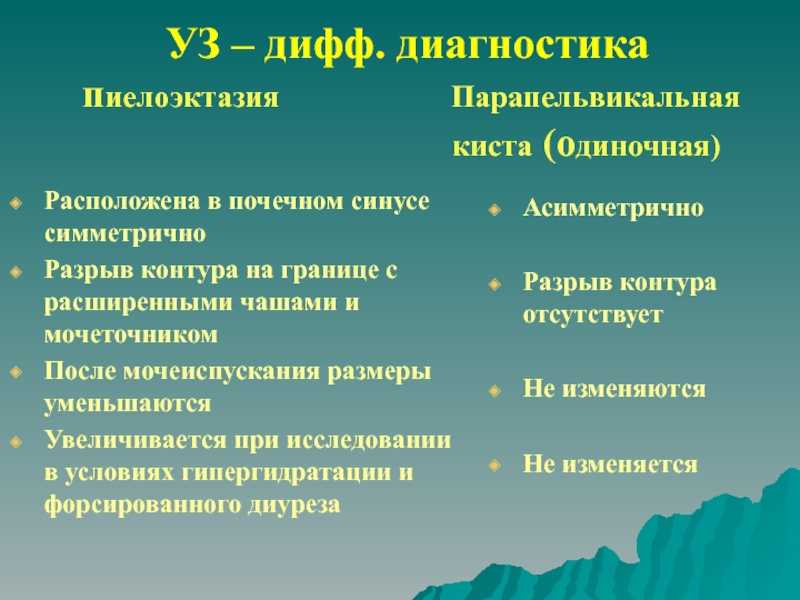 Пиелоэктазия – частая находка на узи