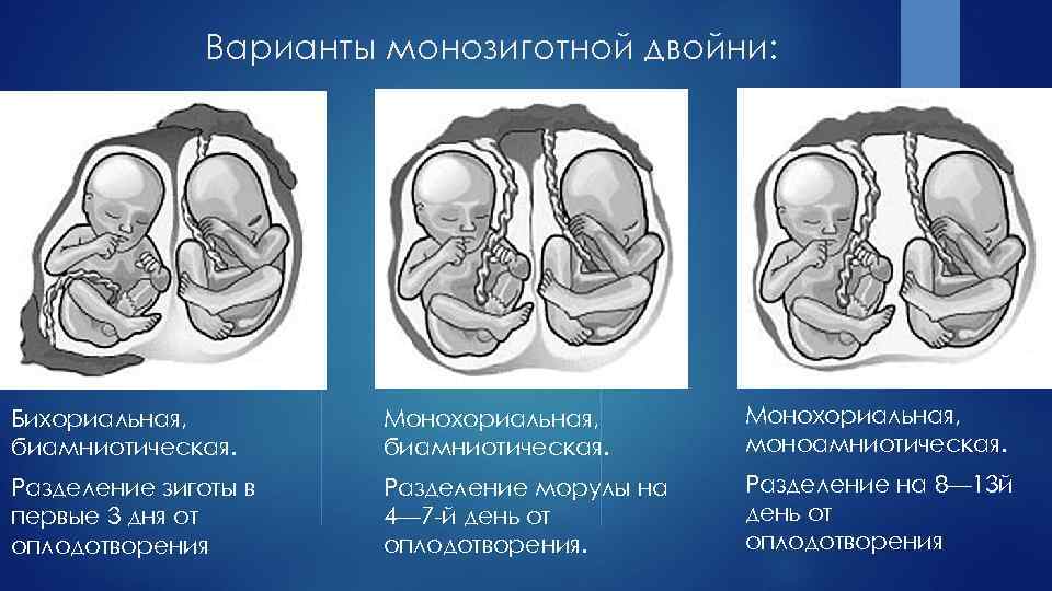 Многоплодие — что ждет будущую маму — патологии