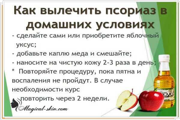 Уксусные ванночки для ног в домашних условиях