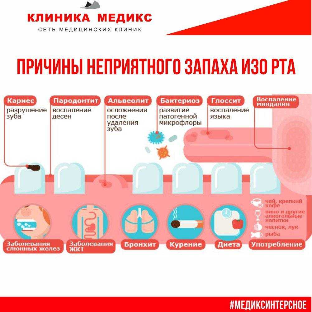 Запах изо рта у ребенка – это важный диагностический симптом!