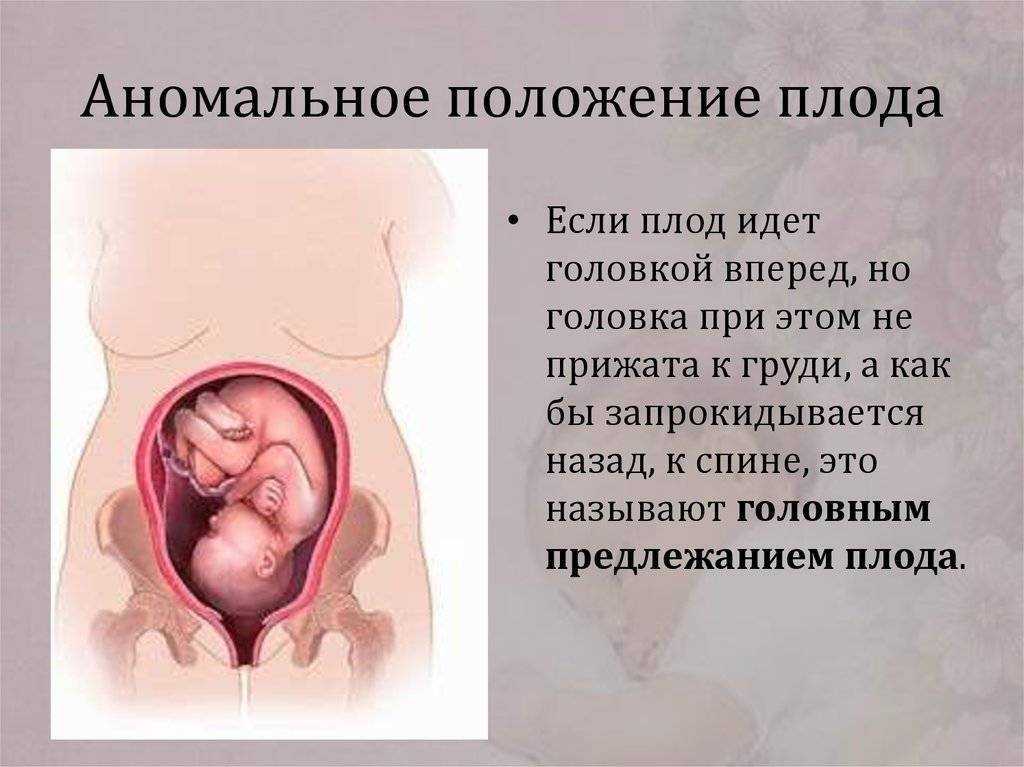 32 недели беременности какой. Расположение плода на 32 неделе беременности. 32 Неделя беременности головное предлежание. Положение плода на 33 неделе беременности. Положениеребннкавживоте.