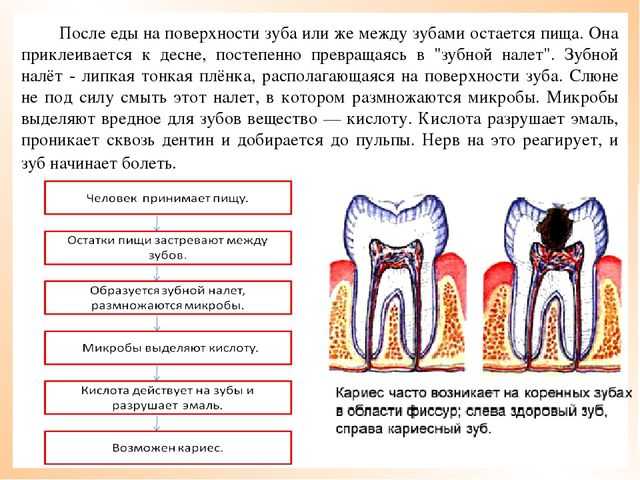 Налет на зубах у ребенка
