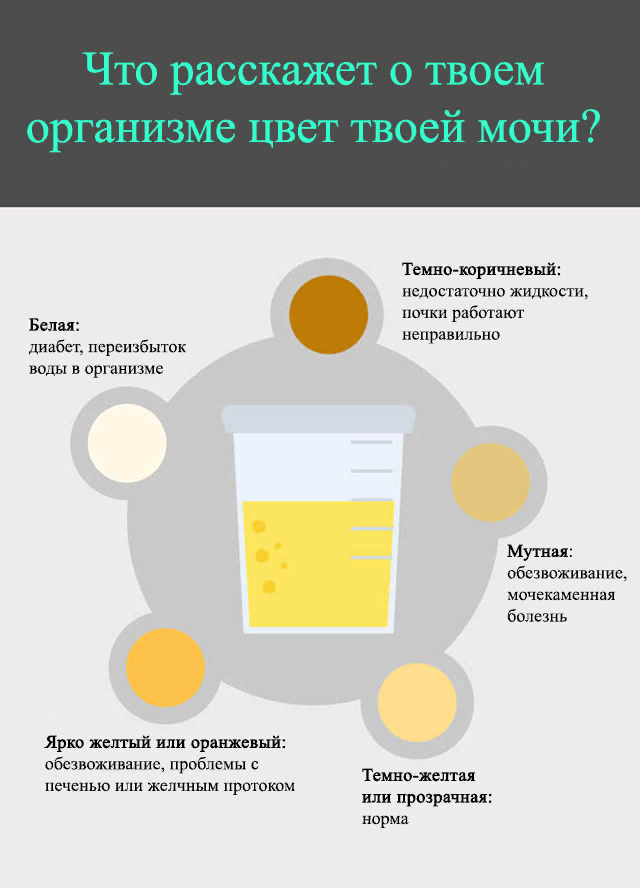 Изменение физических и химических показателей в анализах мочи при различных заболеваниях | университетская клиника