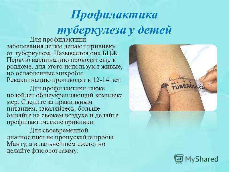 Проба «манту»