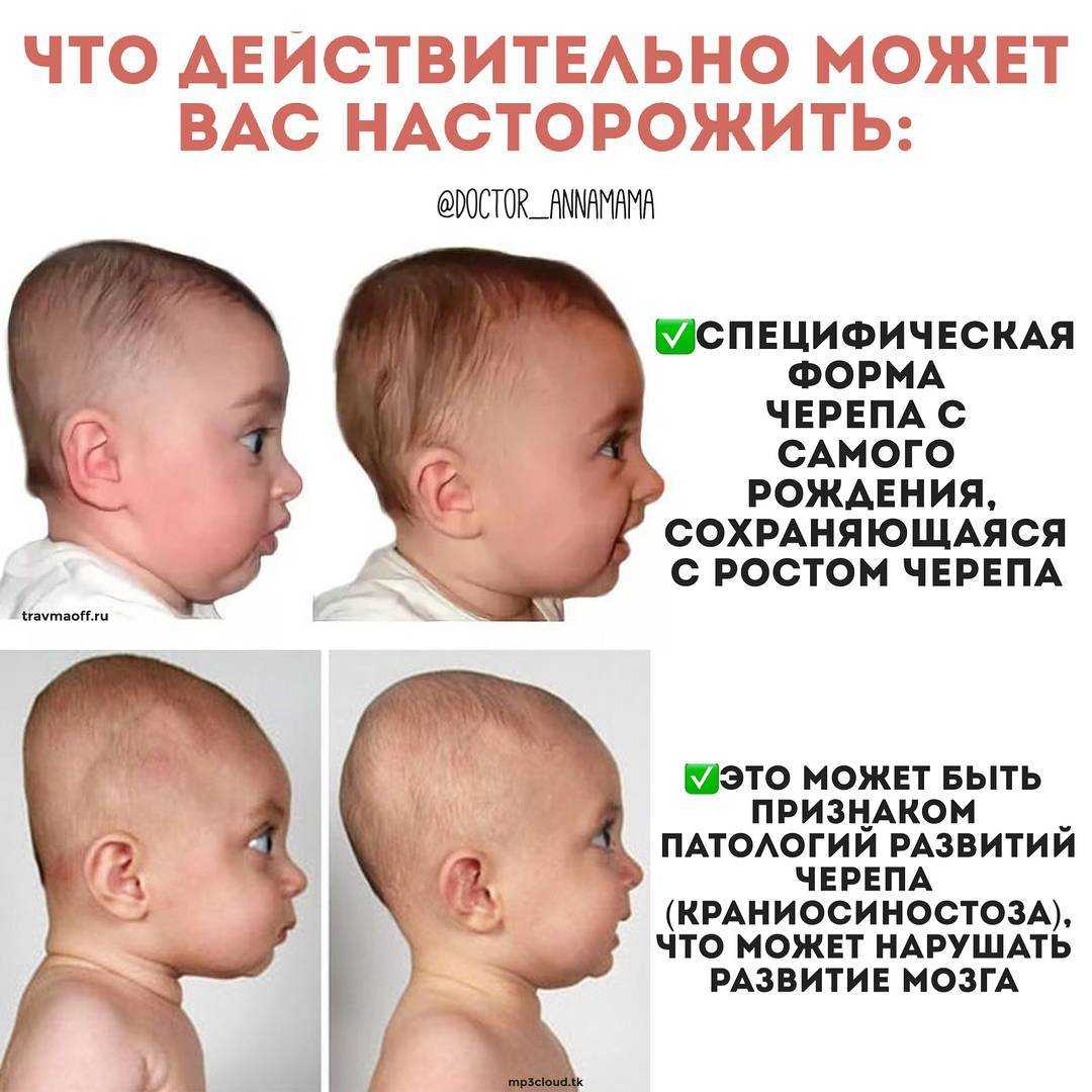 Почему у грудничка пульсирует родничок, нормально ли это: ищем причины пульсации
