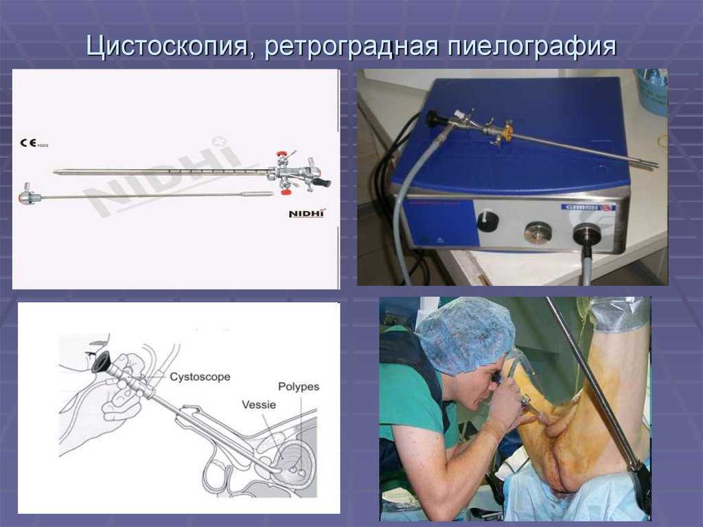 Как проводится урологический осмотр