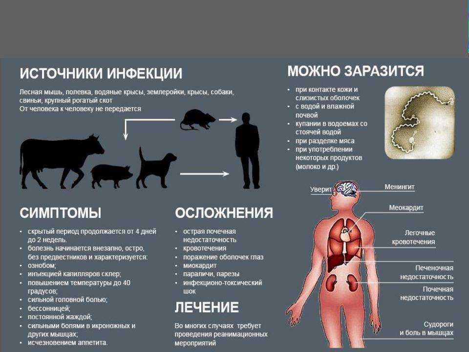 Мышиная лихорадка: инфекционист о заболевании и заражении им, симптоматика, диагностика, терапия, профилактика