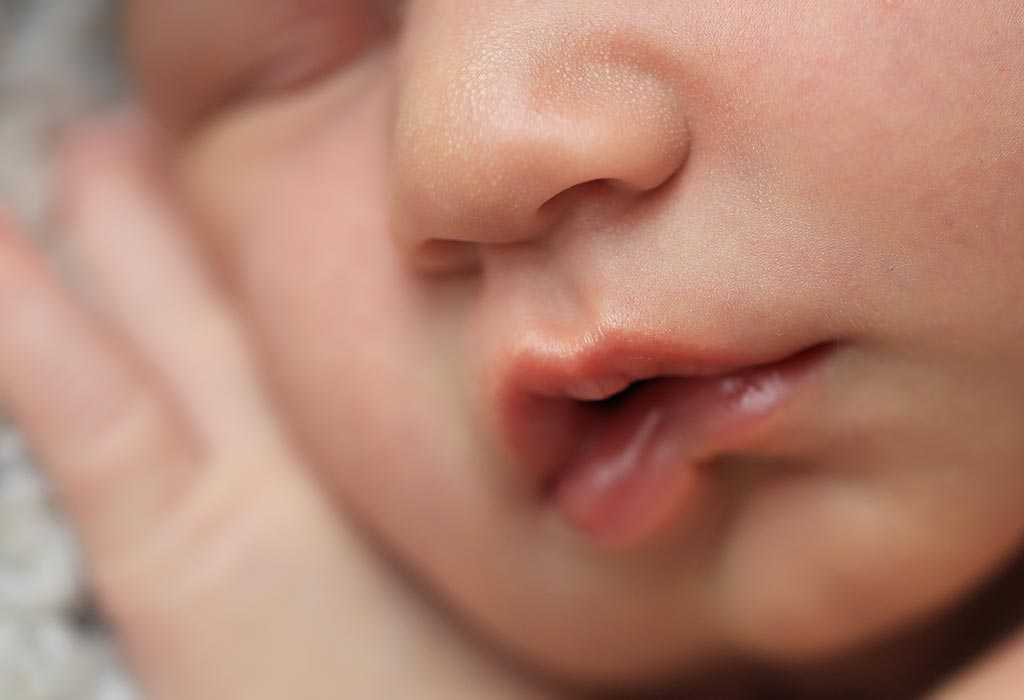 Некоторые новоиспеченные родители на 2-4 неделе жизни новорожденного, замечая у него странное уплотнение на губе по типу мозоли, начинают волноваться Разберемся, есть ли повод для беспокойства и к какому специалисту следует обратиться