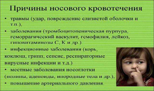 По каким причинам идет кровь из носа ребенка Как этого избежать и что делать если открылось кровотечение
