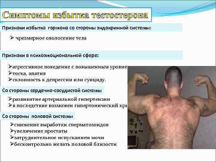Гиперандрогения у женщин