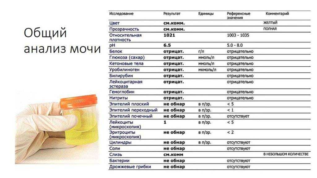 Общий анализ мочи