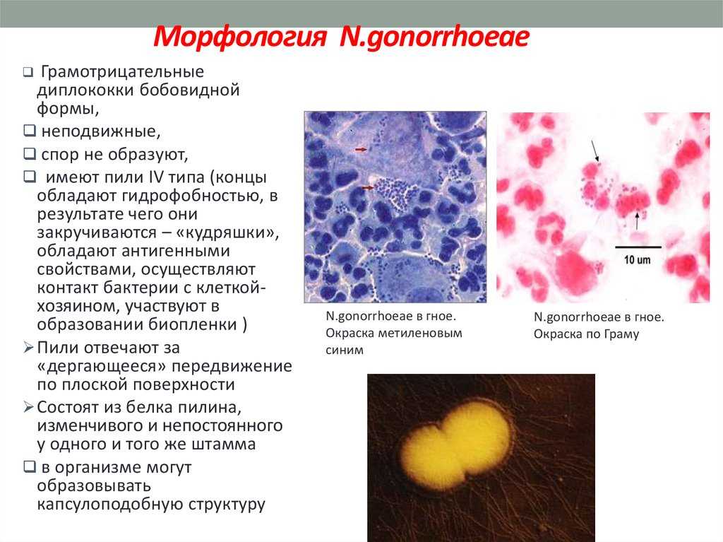Бактериальный вагиноз: причины, симптомы, лечение, препараты