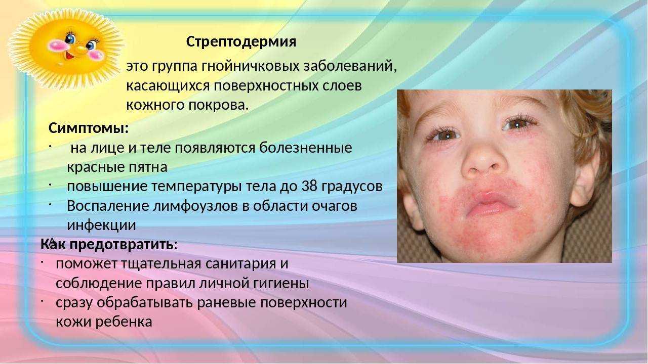 Аллергия у грудничка: симптомы и лечение