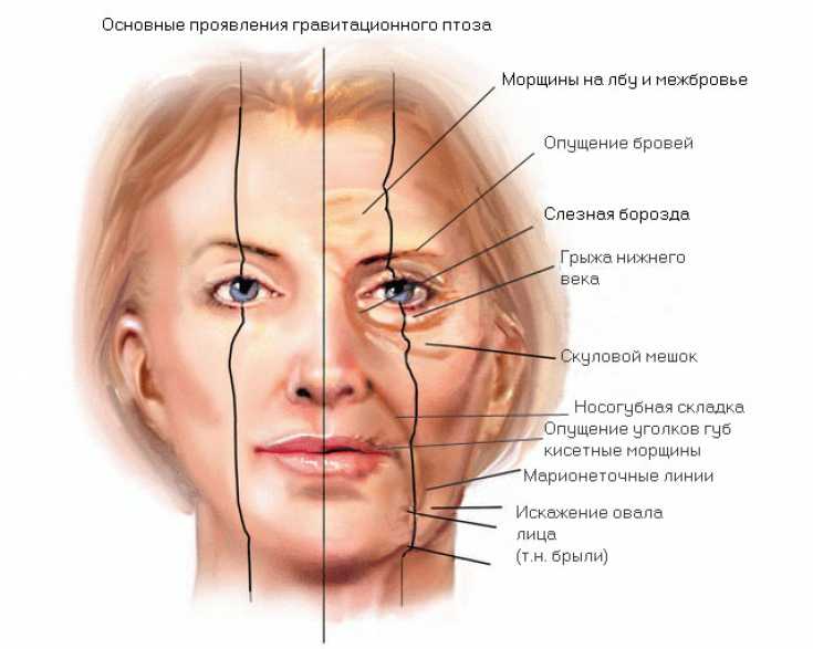 ​типы старения лица