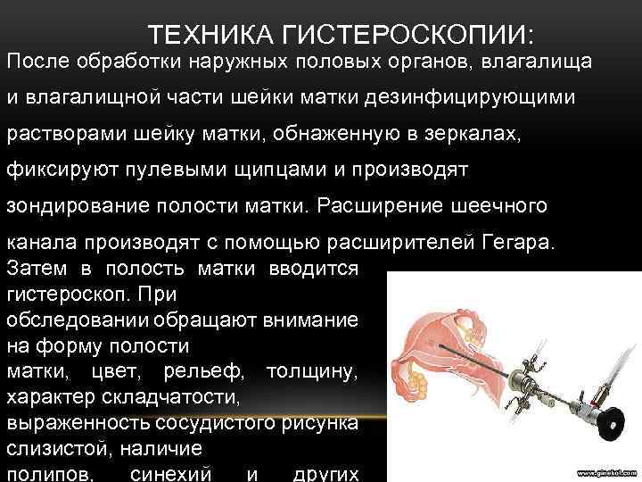 Может ли кульдоцентез спровоцировать онкологию
