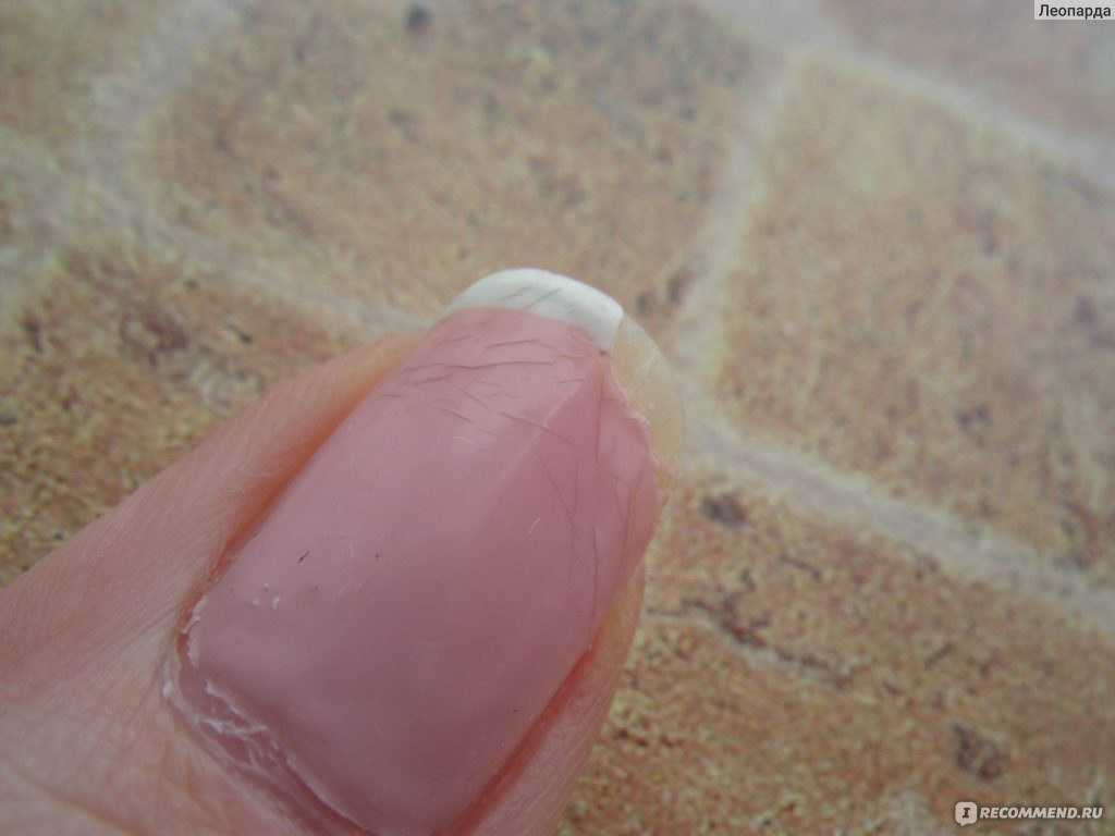 Почему трескается гель-лак на ногтях: причины, советы