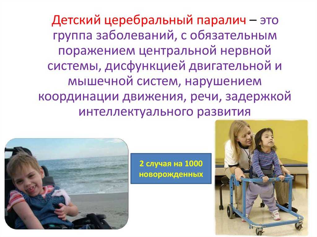 Детский церебральный паралич