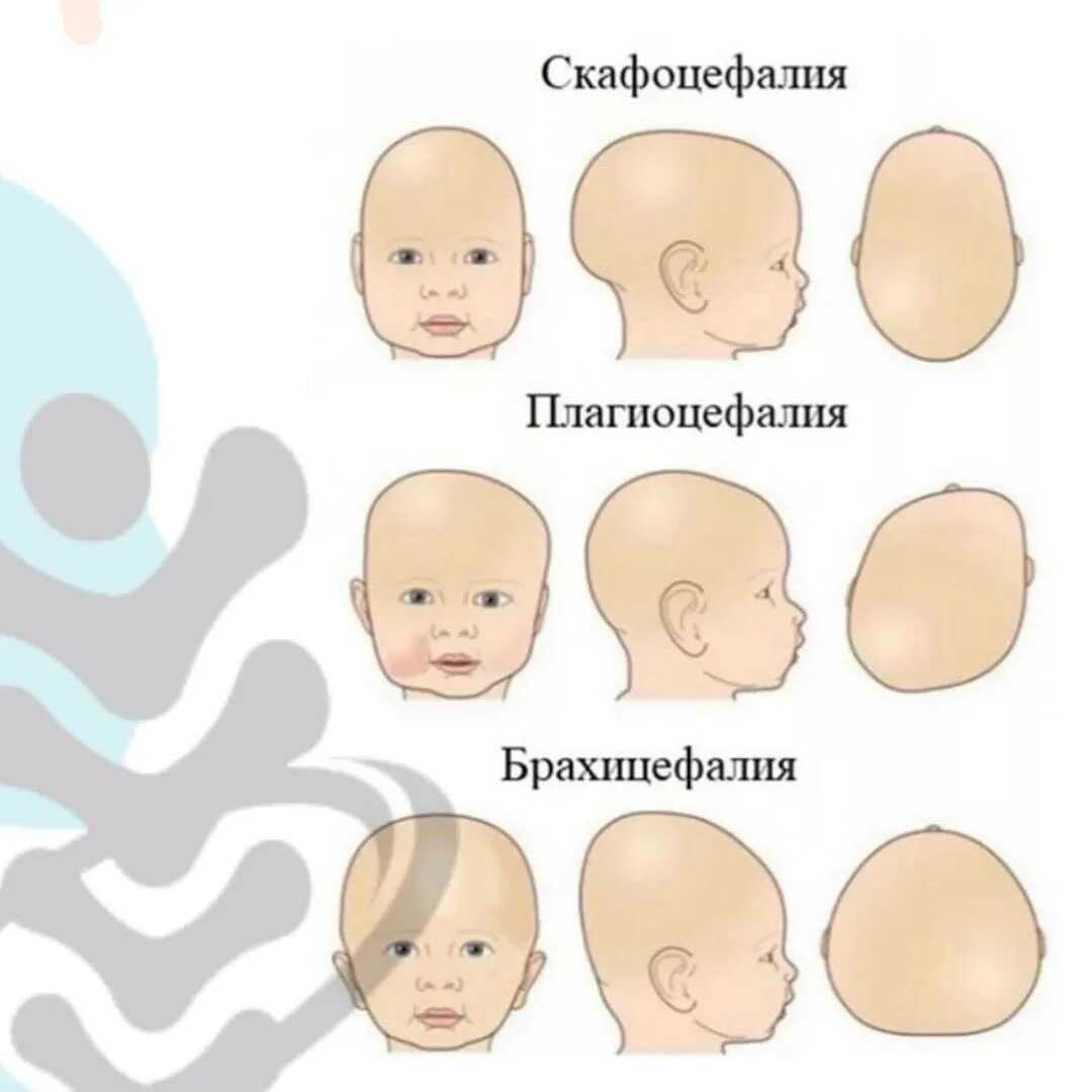 Голова ребенка 4 года