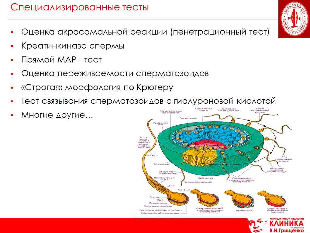 Тератозооспермия