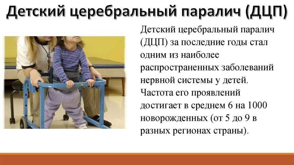 Церебральный паралич лечение. Дети с ДЦП. Детский церебральный паралич. Детский церебральный паралич (ДЦП). Дети больные ДЦП.