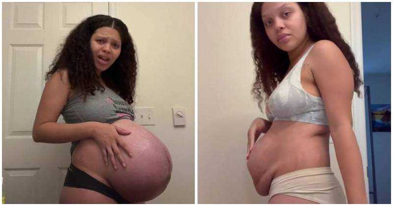 Женщины показали, как на самом деле выглядит тело после родов: 14 фото