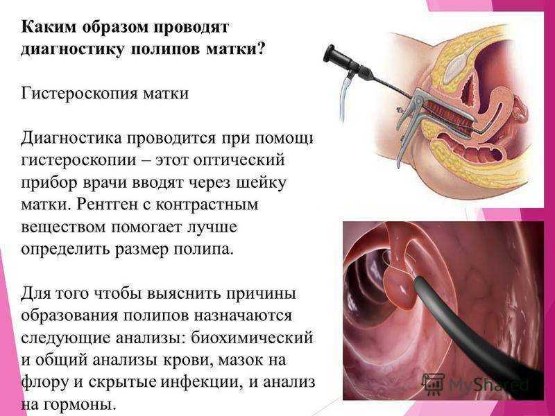 Гинекологическое обследование (кольпоскопия, гистероскопия и пр.). подготовка к гинекологическому осмотру