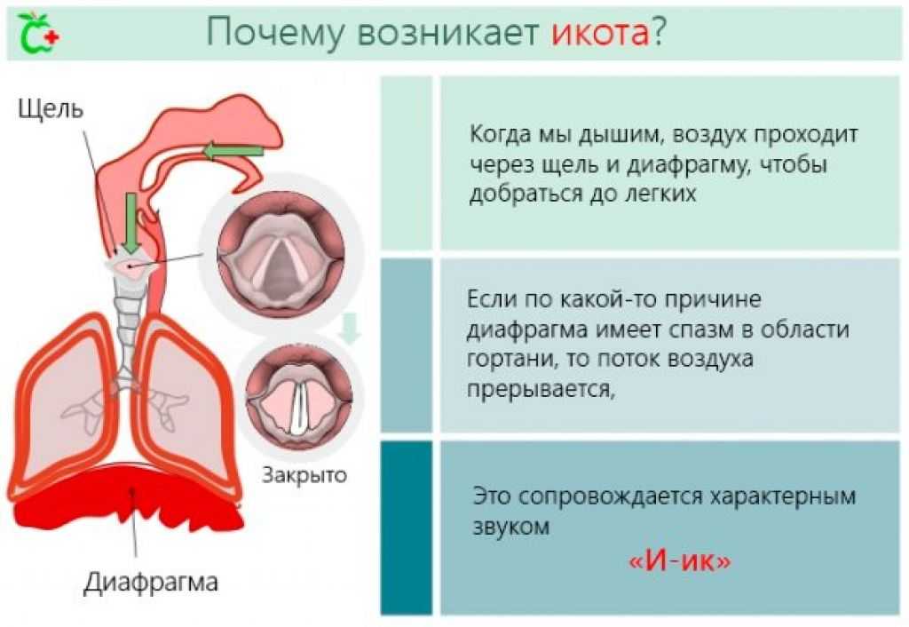 По чему может. Икота. От чего человек икает. Почему икают. Почему человек икает причины.