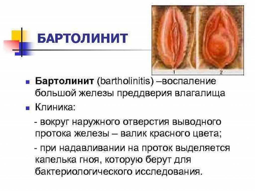 Причины, отчего половые губы большие