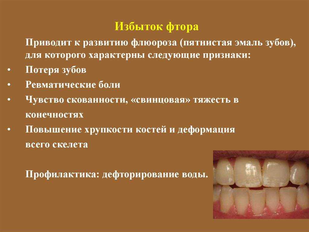 Гипоплазия